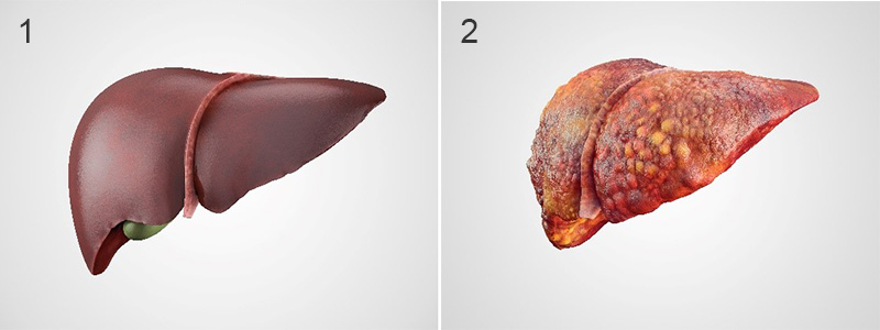 図1:健康な肝臓の状態